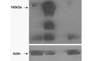 HEK293 overexpressing TANK1 (lane 2) and TANK2 (lane 4) and probed with ABIN570900 (mock transfection in first lane). (TNKS anticorps  (N-Term))