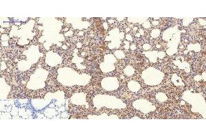 Immunohistochemistry of paraffin-embedded Rat lung tissue using NBR1 Monoclonal Antibody at dilution of 1:200.