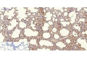 Immunohistochemistry of paraffin-embedded Rat lung tissue using NBR1 Monoclonal Antibody at dilution of 1:200. (NBR1 anticorps)