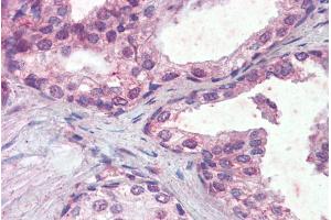 ABIN335143 (5µg/ml) staining of paraffin embedded Human Prostate. (IFNAR2 anticorps  (Internal Region))