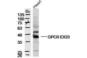 Mouse heart lysates probed with GPCR EX33 Polyclonal Antibody, unconjugated  at 1:300 overnight at 4°C followed by a conjugated secondary antibody at 1:10000 for 90 minutes at 37°C. (GPR84 anticorps  (AA 21-120))
