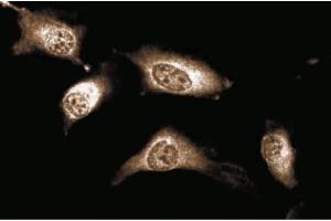 Immunofluorescent staining of Human Endothelial cells. (JAK1 anticorps  (AA 551-766))