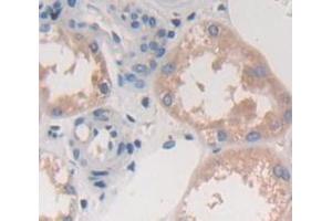 IHC-P analysis of Human Tissue, with DAB staining. (FCN3 anticorps  (AA 34-297))