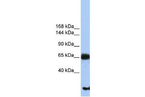 Western Blotting (WB) image for anti-Phosphatidylinositol Glycan Anchor Biosynthesis, Class O (PIGO) antibody (ABIN2459357) (PIGO anticorps)