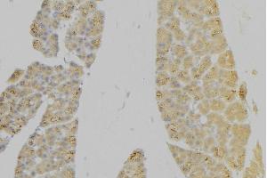 ABIN6276630 at 1/100 staining Human pancreas tissue by IHC-P. (IL7R anticorps  (N-Term))