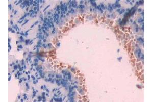 Used in DAB staining on fromalin fixed paraffin- embedded liver tissue