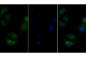 Detection of CSF2Rb in Human Hela cell using Polyclonal Antibody to Colony Stimulating Factor 2 Receptor Beta (CSF2Rb) (CD131 anticorps  (AA 133-233))