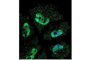 Confocal immunofluorescent analysis of ELAVL1 Antibody (ABIN659118 and ABIN2843759) with NCI- cell followed by Alexa Fluor® 488-conjugated goat anti-mouse lgG (green). (ELAVL1 anticorps)