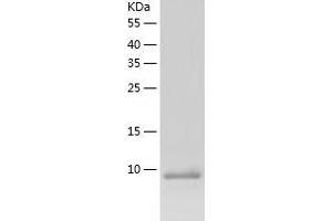 Western Blotting (WB) image for Artemin (ARTN) (AA 108-220) protein (His tag) (ABIN7121900) (ARTN Protein (AA 108-220) (His tag))