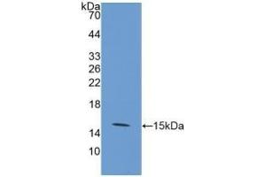 Detection of Recombinant GLUT1, Human using Polyclonal Antibody to Glucose Transporter 1 (GLUT1)