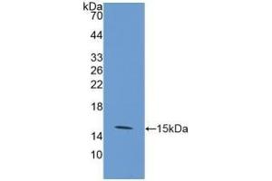 Detection of Recombinant GLUT1, Human using Polyclonal Antibody to Glucose Transporter 1 (GLUT1) (GLUT1 anticorps  (AA 251-329))