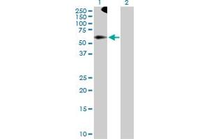 Western Blot analysis of TRIM9 expression in transfected 293T cell line by TRIM9 MaxPab polyclonal antibody. (TRIM9 anticorps  (AA 1-550))