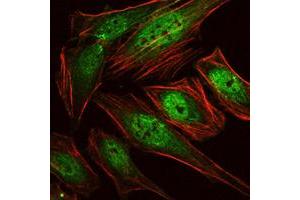 Immunofluorescence staining of HeLa cells using RUNX1 monoclonal antibody, clone 5A1 (Green).