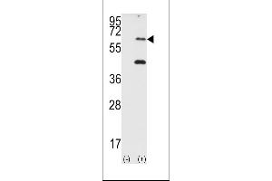 Western blot analysis of EIF2AK2 (arrow) using PRKR Antibody (N-term) (ABIN392778 and ABIN2837994). (EIF2AK2 anticorps  (N-Term))