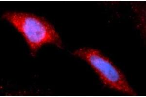 Immunofluorescence (IF) image for anti-Hexokinase 2 (HK2) (AA 1-917) antibody (APC) (ABIN5565592) (Hexokinase 2 anticorps  (AA 1-917) (APC))