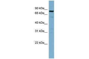 WB Suggested Anti-STAT3 Antibody Titration: 0. (STAT3 anticorps  (Middle Region))