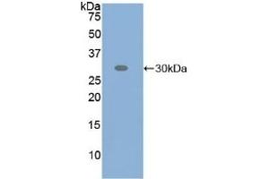 Detection of Recombinant ATF6, Human using Polyclonal Antibody to Activating Transcription Factor 6 (ATF6) (ATF6 anticorps  (AA 423-646))