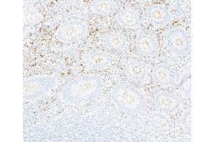 Immunohistochemistry (IHC) image for anti-Interferon alpha/beta Receptor 1 (IFNAR1) (AA 27-436) antibody (ABIN7795661) (Recombinant IFNAR1 anticorps  (AA 27-436))