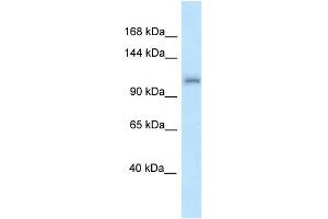 WB Suggested Anti-Zfr Antibody Titration: 1. (ZFR anticorps  (N-Term))