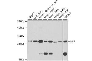 Western blot analysis of extracts of various cell lines, using MIP antibody (ABIN3016917, ABIN3016918, ABIN3016919 and ABIN6219879) at 1:1000 dilution. (Mip (AA 50-150) anticorps)