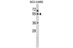 Image no. 1 for anti-Fibrinogen gamma Chain (FGG) (C-Term), (Chain gamma) antibody (ABIN453006) (FGG anticorps  (C-Term, Chain gamma))