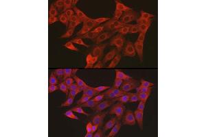 Immunofluorescence analysis of NIH/3T3 using R1 antibody (ABIN3023489, ABIN3023490, ABIN3023491 and ABIN6220077) at dilution of 1:50.