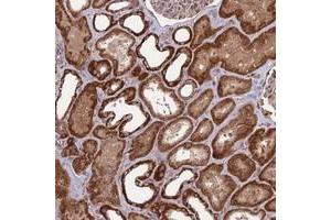 Immunohistochemical staining of human kidney with NDUFC1 polyclonal antibody  shows strong cytoplasmic positivity in cells in tubules. (NDUFC1 anticorps)