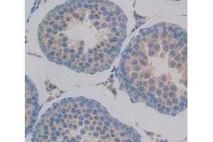 Used in DAB staining on fromalin fixed paraffin- embedded Kidney tissue (GMFB anticorps  (AA 2-142))