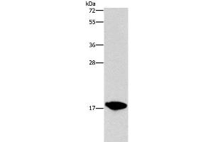 Western Blot analysis of HepG2 cell using CCL16 Polyclonal Antibody at dilution of 1:760 (CCL16 anticorps)