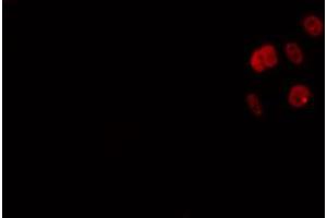 anti-Ankyrin Repeat Domain 30A (ANKRD30A) (Internal Region) antibody