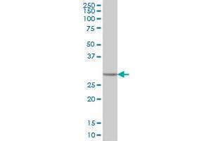 CA1 monoclonal antibody (M05), clone M1 Western Blot analysis of CA1 expression in HeLa .