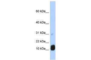 WB Suggested Anti-GCHFR Antibody Titration:  0. (GCHFR anticorps  (N-Term))