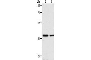 Western Blotting (WB) image for anti-Calponin 3, Acidic (CNN3) antibody (ABIN2422402) (CNN3 anticorps)