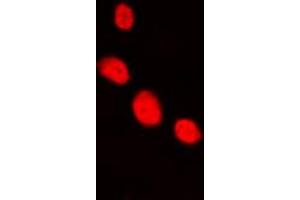 Immunofluorescent analysis of LHX1 staining in HepG2 cells.