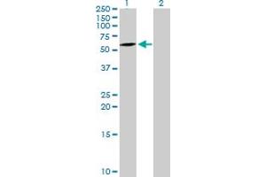 Western Blot analysis of ATG16L1 expression in transfected 293T cell line by ATG16L1 MaxPab polyclonal antibody. (ATG16L1 anticorps  (AA 1-523))