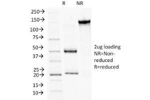 SDS-PAGE Analysis Purified CD56 Monoclonal Antibody (NCAM1/784). (Plakophilin 1 anticorps  (N-Term))
