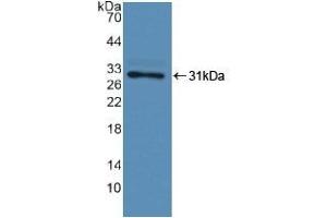 Detection of Recombinant F13A1, Human using Polyclonal Antibody to Coagulation Factor XIII A1 Polypeptide (F13A1)