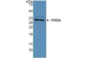 Detection of Recombinant F13A1, Human using Polyclonal Antibody to Coagulation Factor XIII A1 Polypeptide (F13A1) (F13A1 anticorps  (AA 107-345))