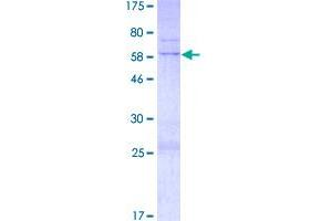 Image no. 1 for TNFRSF1A-Associated Via Death Domain (TRADD) (AA 1-312) protein (GST tag) (ABIN1323490)