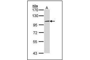 Sample (30 µg of whole cell lysate). (TLR3 anticorps)