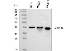 Western blot analysis of MASPIN/SERPINB5 using anti-MASPIN/SERPINB5 antibody (ABIN3043330).