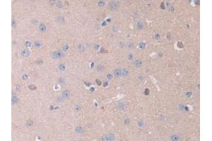 Detection of IL13Ra2 in Mouse Cerebrum Tissue using Polyclonal Antibody to Interleukin 13 Receptor Alpha 2 (IL13Ra2) (IL13RA2 anticorps  (AA 228-338))