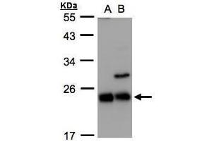 WB Image Sample(30 ug whole cell lysate) A:293T B:Raji , 12% SDS PAGE antibody diluted at 1:1000 (CBFB anticorps)
