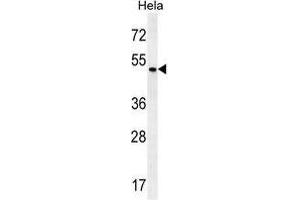 ZMYND17 Antibody (C-term) western blot analysis in Hela cell line lysates (35 µg/lane). (ZMYND17 anticorps  (C-Term))