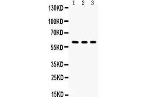 Western Blotting (WB) image for anti-V-Yes-1 Yamaguchi Sarcoma Viral Oncogene Homolog 1 (YES1) (AA 7-35), (N-Term) antibody (ABIN3042333) (YES1 anticorps  (N-Term))