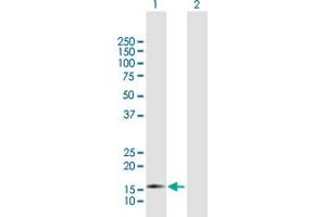 Western Blot analysis of ZMAT4 expression in transfected 293T cell line by ZMAT4 MaxPab polyclonal antibody.
