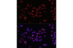 Immunofluorescence analysis of PC-12 cells using Acetyl-Histone H3-K27 Rabbit mAb (ABIN3016650, ABIN3016651, ABIN3016652, ABIN1682513 and ABIN1682514) at dilution of 1:100 (40x lens).