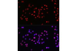 Immunofluorescence analysis of PC-12 cells using Acetyl-Histone H3-K27 Rabbit mAb (ABIN3016650, ABIN3016651, ABIN3016652, ABIN1682513 and ABIN1682514) at dilution of 1:100 (40x lens). (Histone H3 (Acetyl K27) (acLys27) anticorps)