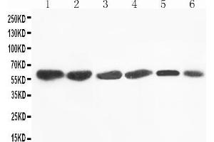 Anti-Flavin containing monooxygenase 4 antibody, Western blotting Lane 1: Rat Liver Tissue Lysate Lane 2: Mouse Liver Tissue Lysate Lane 3: SMMC Cell Lysate Lane 4: HEPA Cell Lysate Lane 5: A431 Cell Lysate Lane 6: MCF-7 Cell Lysate (FMO4 anticorps  (N-Term))