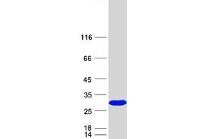 Sjogren Syndrome/scleroderma Autoantigen 1 (SSSCA1) protein (Myc-DYKDDDDK Tag)